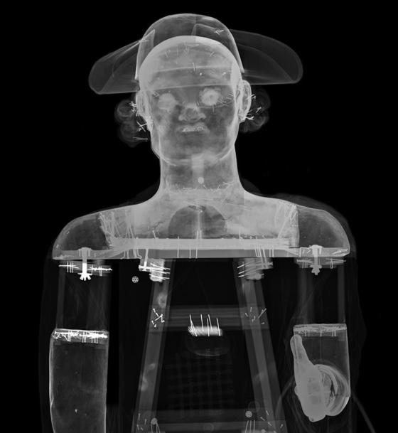 Radiografia. (Foto: IRP.) Radiografia. (Foto: IRP.)